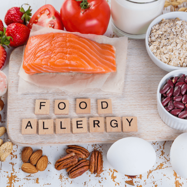 The Best FREE Allergen Course For Your Staff